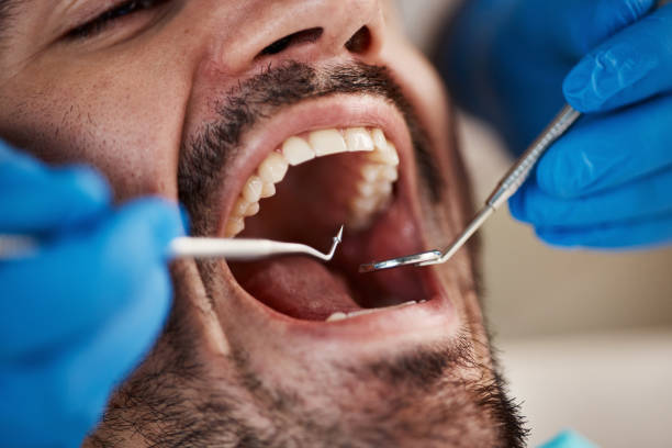 Tooth Infection Emergency Dentist in NC
